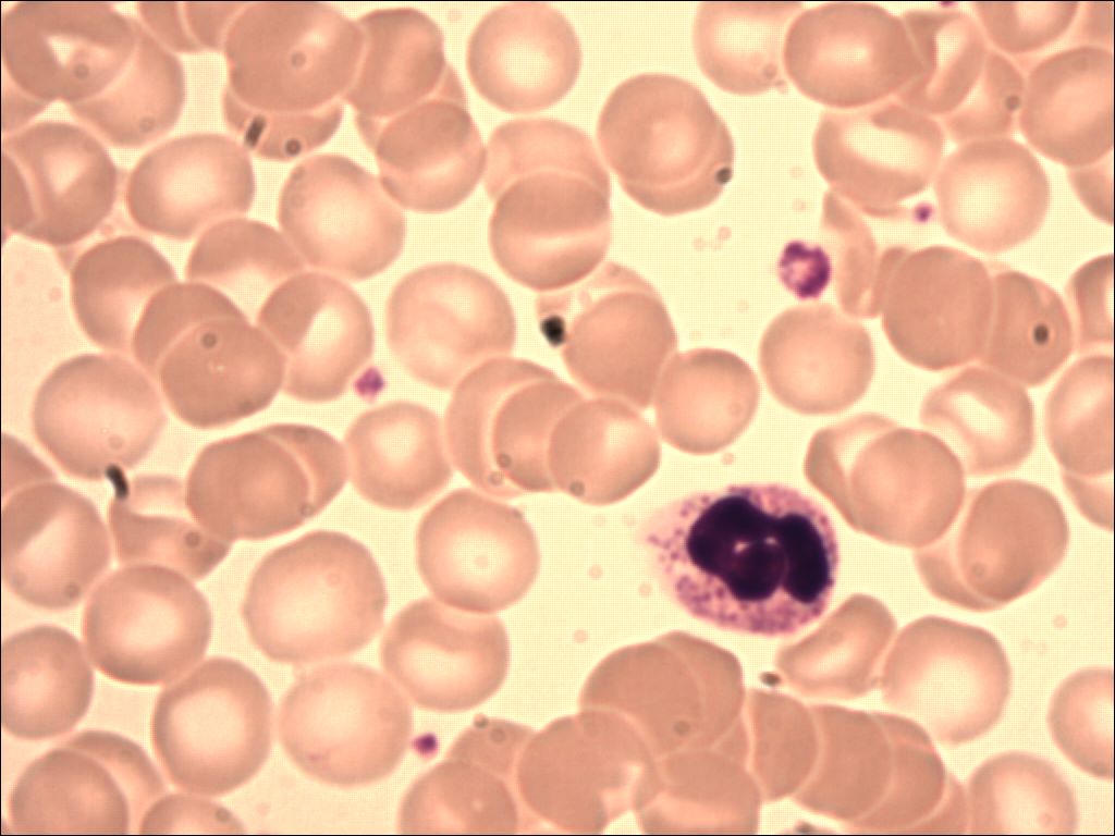 neutrophil