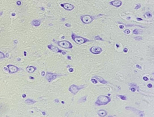 Pyramidal Neuron