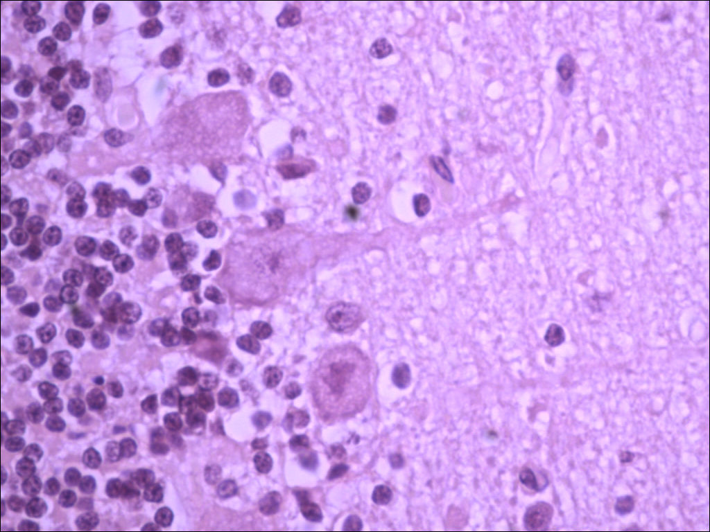 Pyramidal Neuron