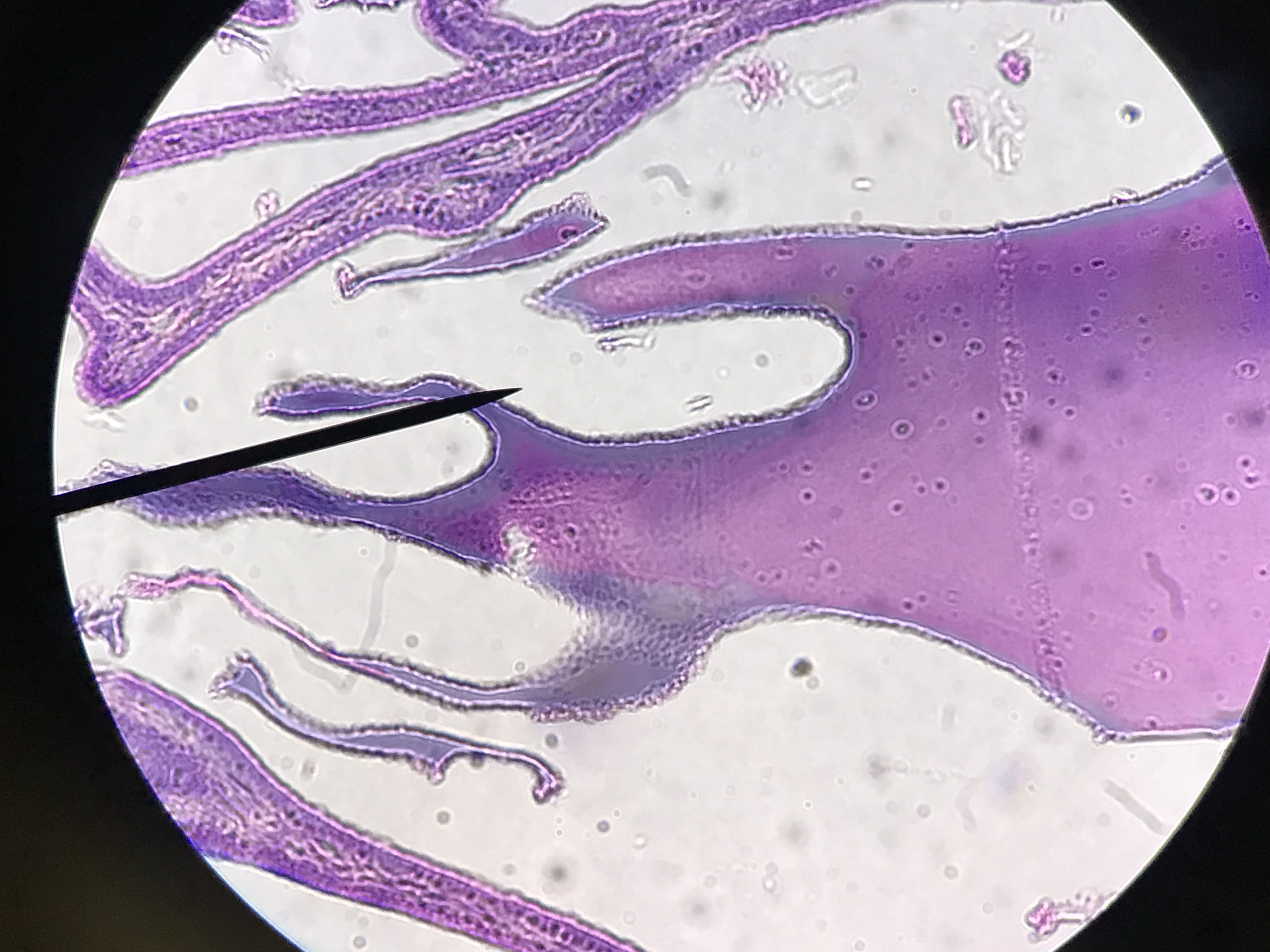 seminal vesicles