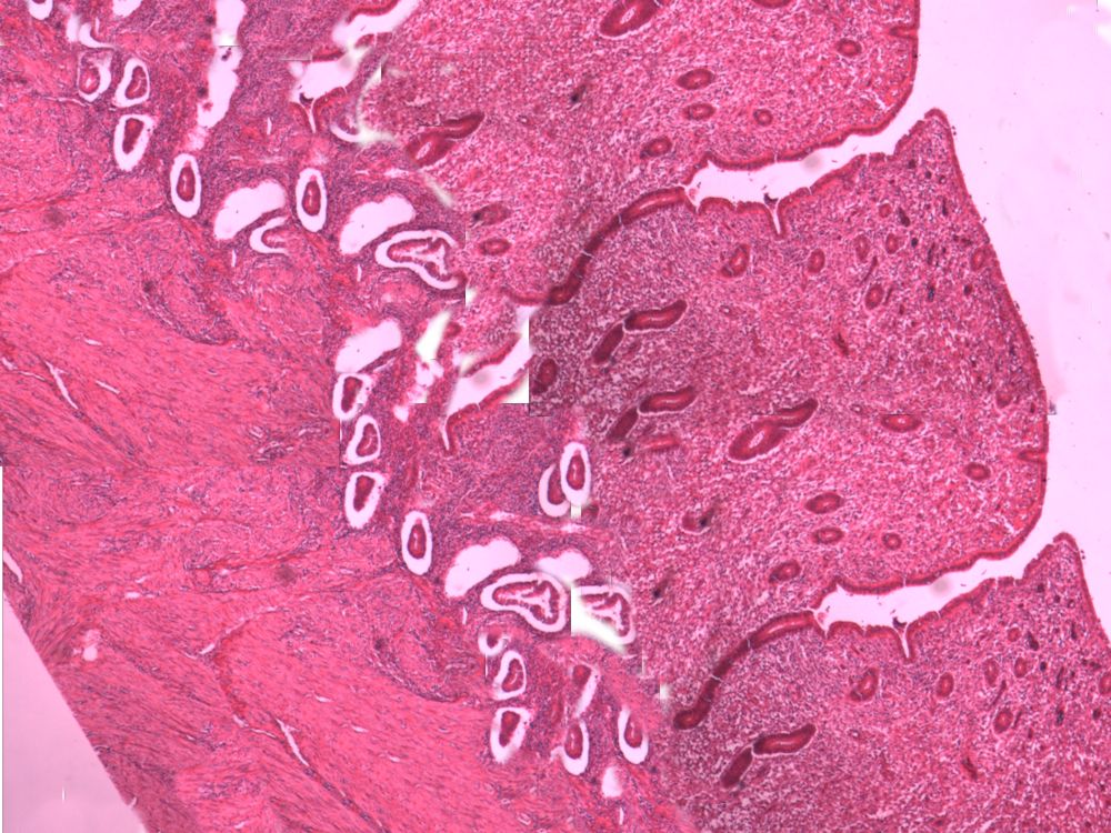 Uterus