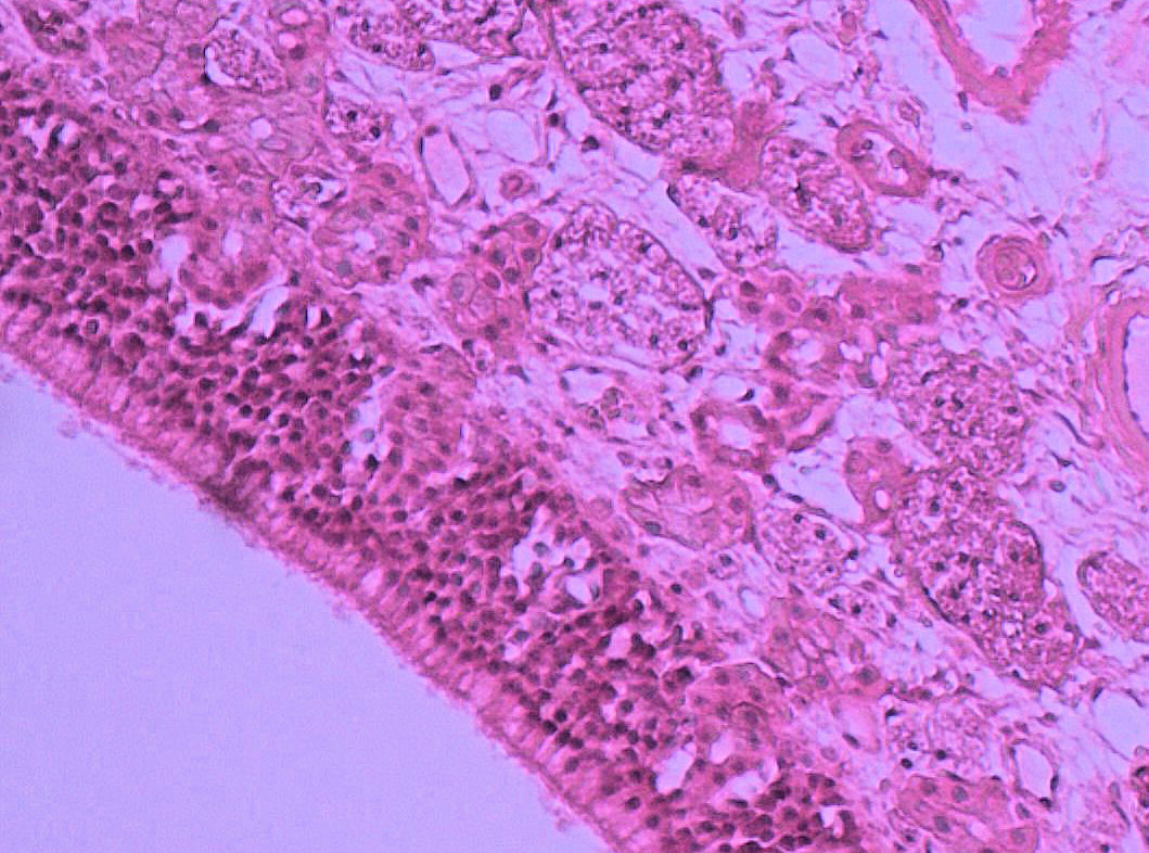 nasal epithelium