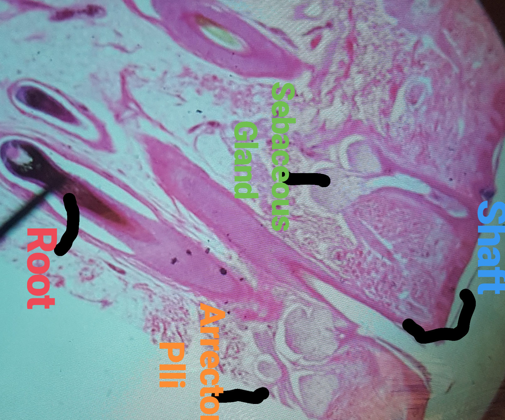 Sebaceous  Gland